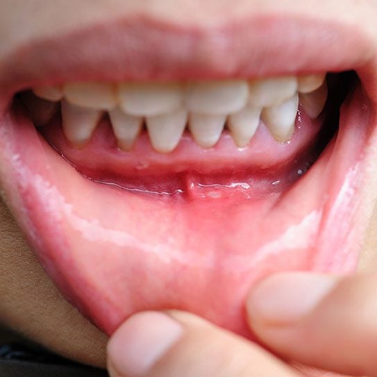 Pediatric Dentists