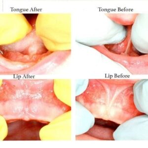 - Young Dentistry for Children