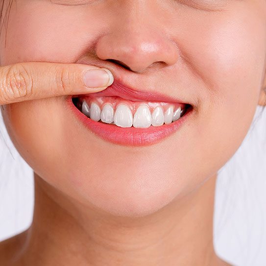 - Young Dentistry for Children