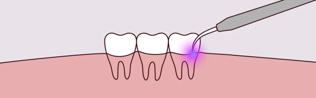 - Young Dentistry for Children